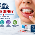 Why are my gums bleeding?